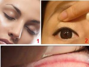 眼睛里进东西怎么办?眼睛进异物怎么办