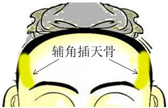 骨相图解:辅角插天骨