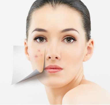 脸上长痘痘是什么原因?脸上长痘痘怎么调理?青春痘怎么消除