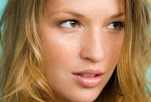 正确认识黄褐斑 黄褐斑如何预防?