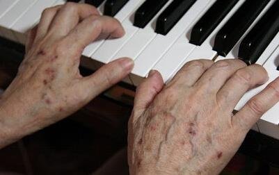 长了老年斑就别再暴晒了!危险