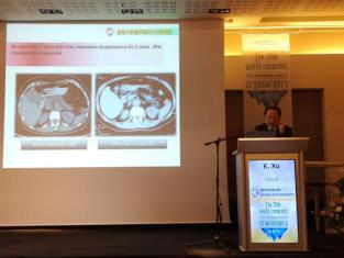 济南肿瘤医院选择广州复大肿瘤医院:冷冻需要新理念