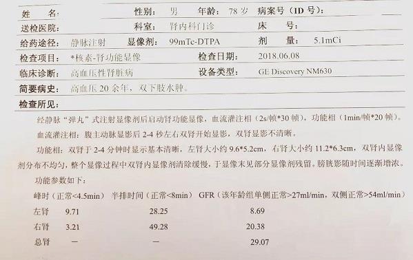 青岛静康医院案例:明明是重度肾衰,血肌酐却正常!化验单会说谎吗?