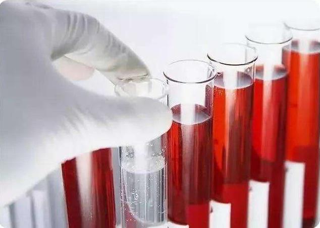 青岛静康医院案例:明明是重度肾衰,血肌酐却正常!化验单会说谎吗?