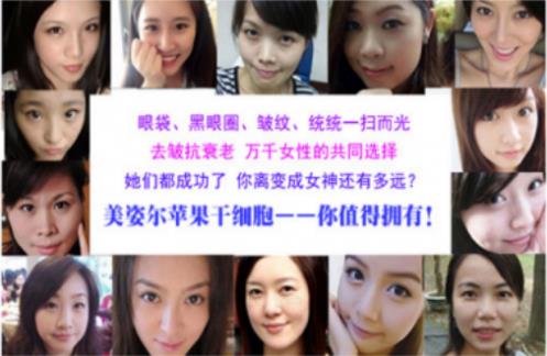 眼下有眼袋怎么消除 让你告别肿泡眼的方法