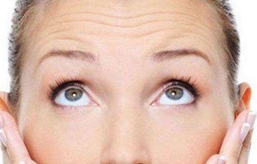 抬头纹去除:有什么办法能去除抬头纹