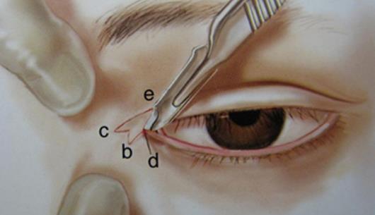 ���۽�������ʲô���� ʲô������Ⱥ�ʺϿ��۽�����