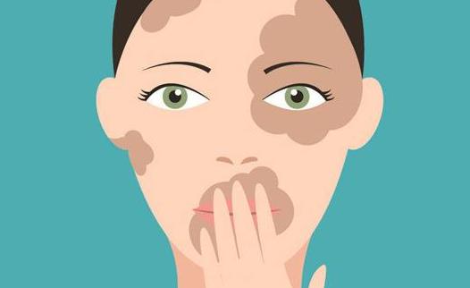 白癜风有哪些治疗方式?患了白癜风怎么护理及预防?