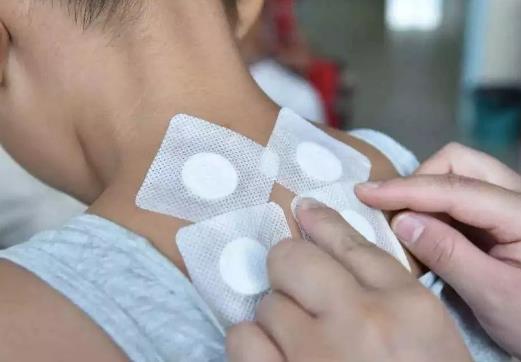 三伏贴现调的能放多久?三伏贴不在三伏天贴敷可以吗?