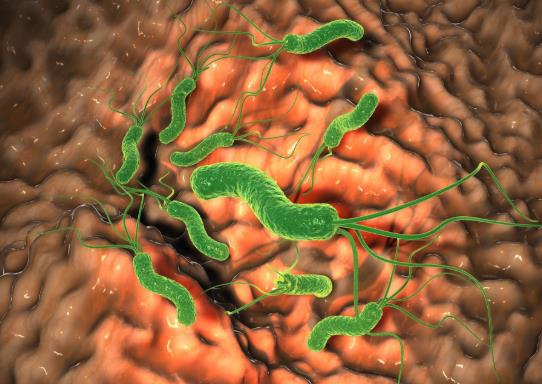 得了幽门螺杆菌怎么治疗?得了幽门螺旋杆菌全家都会被传染吗