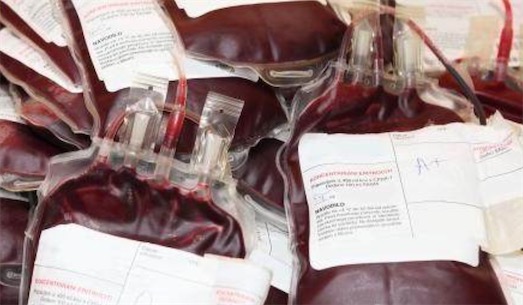 世界上最稀有的血型 Rhnull血型全球仅43人