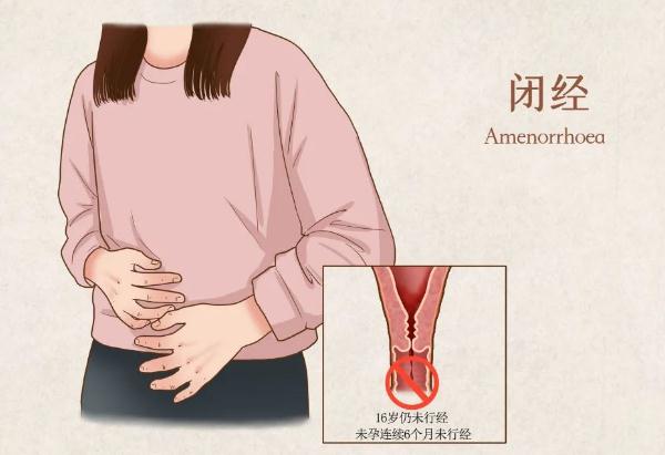 闭经是怎么回事?造成闭经的原因有哪些?
