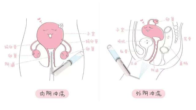 Ů��������ʲô���ӵ�ͼƬ���� ������ʵ������ʽṹͼ