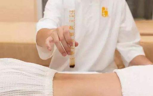 三九灸不做预灸可以吗 冬天为什么要做三九灸