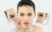 赶走黄褐斑 还你白净肌肤