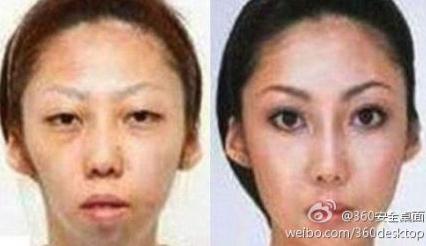 【老婆太丑】老婆漂亮女儿太丑，男子告整容老婆获赔75万，是整容医院炒作吗