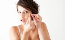 这些祛痘的治疗偏方你知道吗？