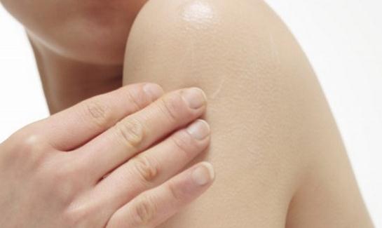 秋季皮肤干燥？拒绝干燥做个水女人！