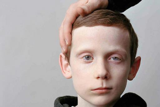 注重6个细节帮助你远离面瘫