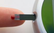 糖尿病患者腰围超标 血糖难控制