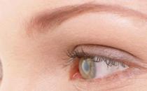 长期对着电脑眼睛痛怎么办