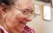 6招教你如何预防老花眼