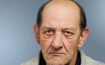 上了年纪容易患的眼部疾病