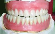 假牙的种类 老人怎样戴假牙安全健康