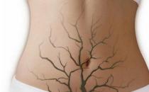 哪些不良习惯会导致便秘