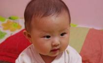 冬季养生 宝宝嘴唇干裂怎么办