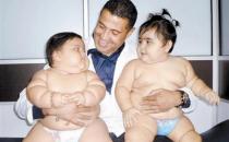 胖小孩长大后会自然瘦掉吗