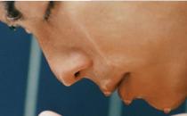 男性如何护理好冬季干燥的皮肤