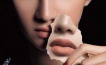 去黑头5大方法 谨防黑头泛滥成灾