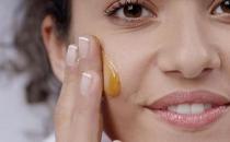 滥用化妆品也会长雀斑