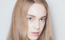 女生头皮屑多又痒怎么办