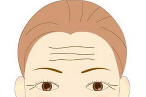 美容达人教你怎样防治抬头纹