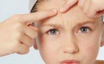 上火长痘怎么办?4种食物降火灭痘