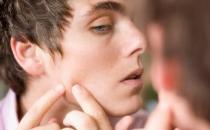 男人脸上长痘怎么办 推荐三个祛痘方法