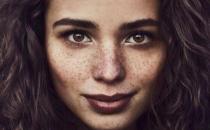 雀斑是如何形成的 找准原因去雀斑