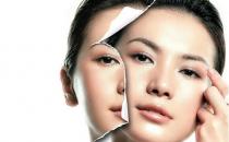 注射美白针美白有哪些误区