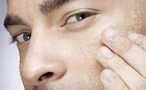 男人消除黑眼圈的六个小方法