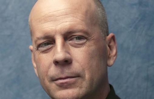 秃头男是怎样炼成的？