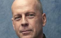 秃头男是怎样炼成的？