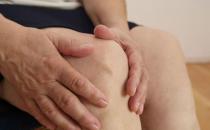 关节炎用药不慎易高血压