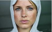 女人爱长黄褐斑的7大原因