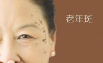 老人怎样饮食能减少老人斑