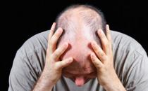 6招简单防男性脱发