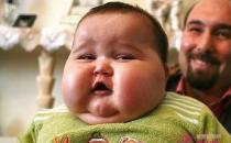 小儿肥胖症的原因