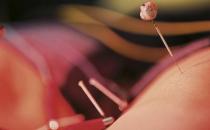 针灸减肥有哪些饮食注意事项