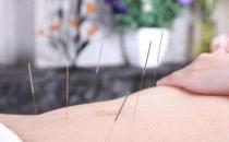 针灸美容内外调养更美颜